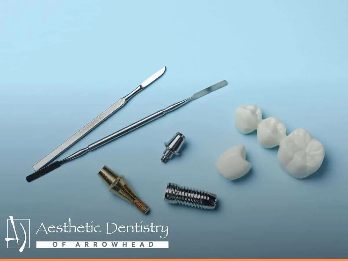 Damaged dental bridge in Arizona