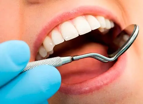 Porcelain veneers being placed at our Glendale dental office