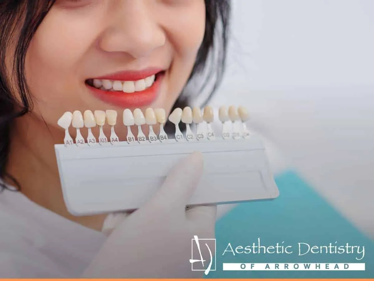 Get Your Teeth Whitened With Aesthetic Dentistry Of Arrowhead