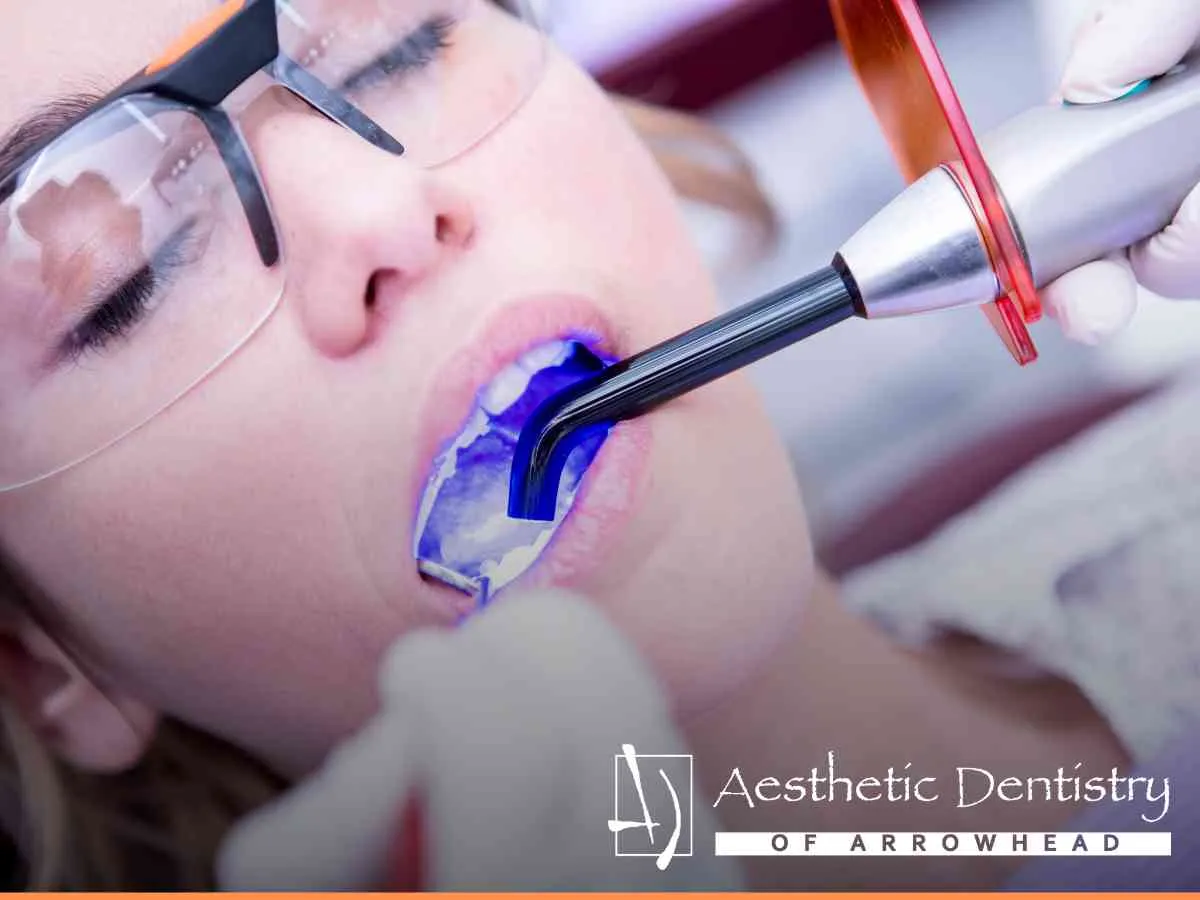Dentist applying a white dental filling to a patient's tooth using a curing light.