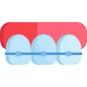 Ceramic braces