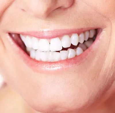 Dentures
