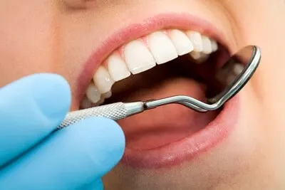 Enamel Shaping