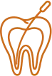 Root Canal Therapy procedure for tooth infection relief