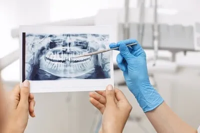 Oral Cancer Screening