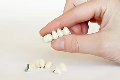 Porcelain Bridges