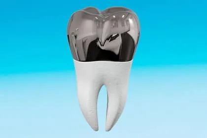 Stainless Steel Crowns For Pediatric Dentistry Near Peoria