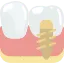 Tooth implant procedure near Phoenix 85024