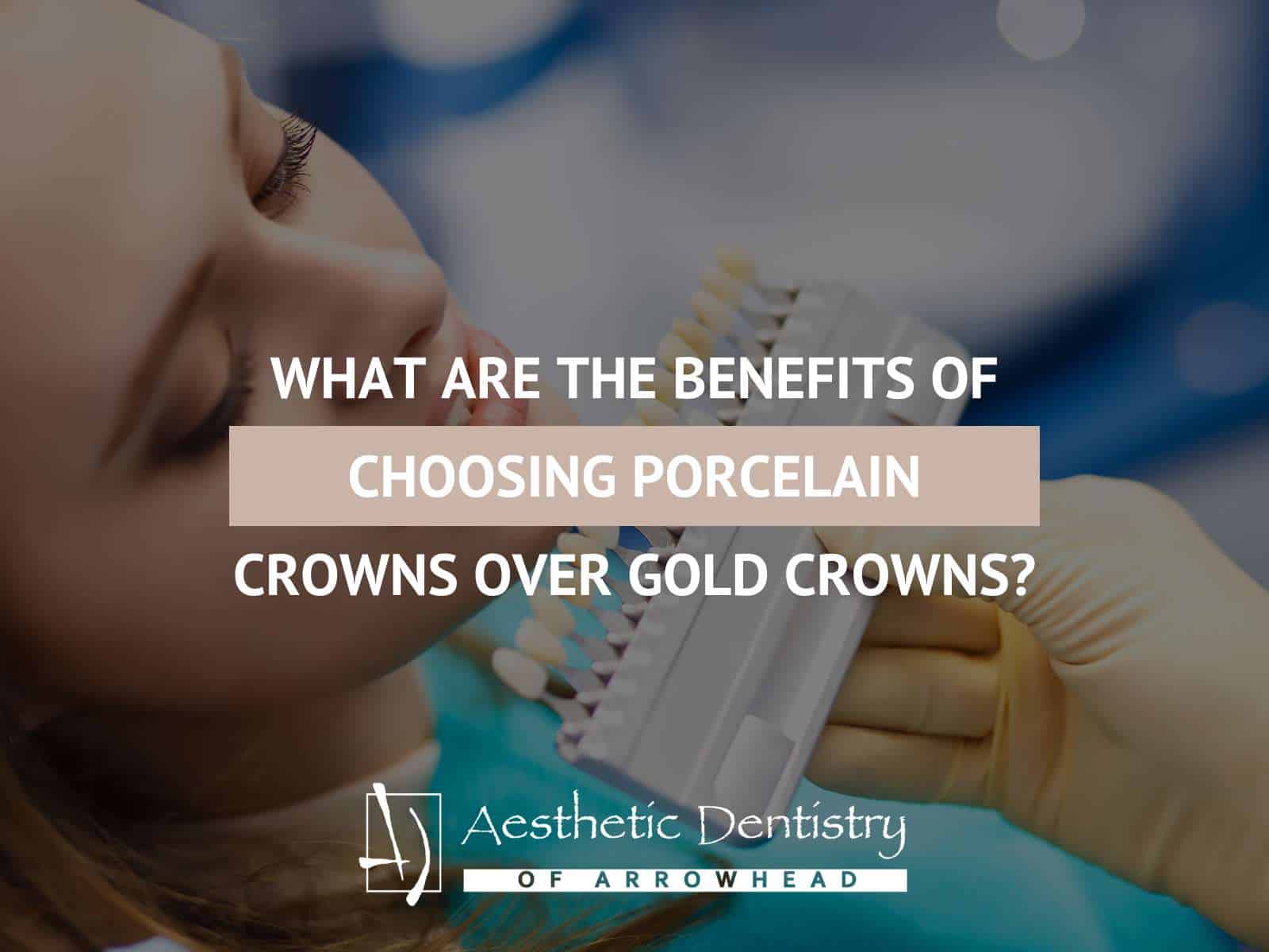 What Are The Benefits Of Choosing Porcelain Crowns Over Gold Crowns?