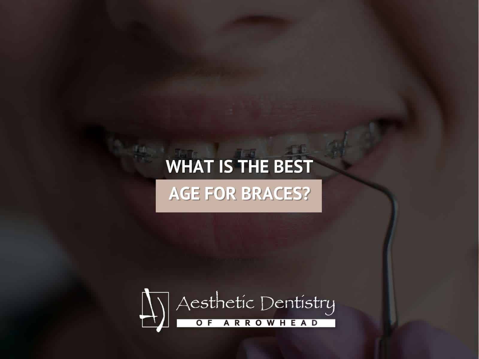 What Is The Best Age For Braces?