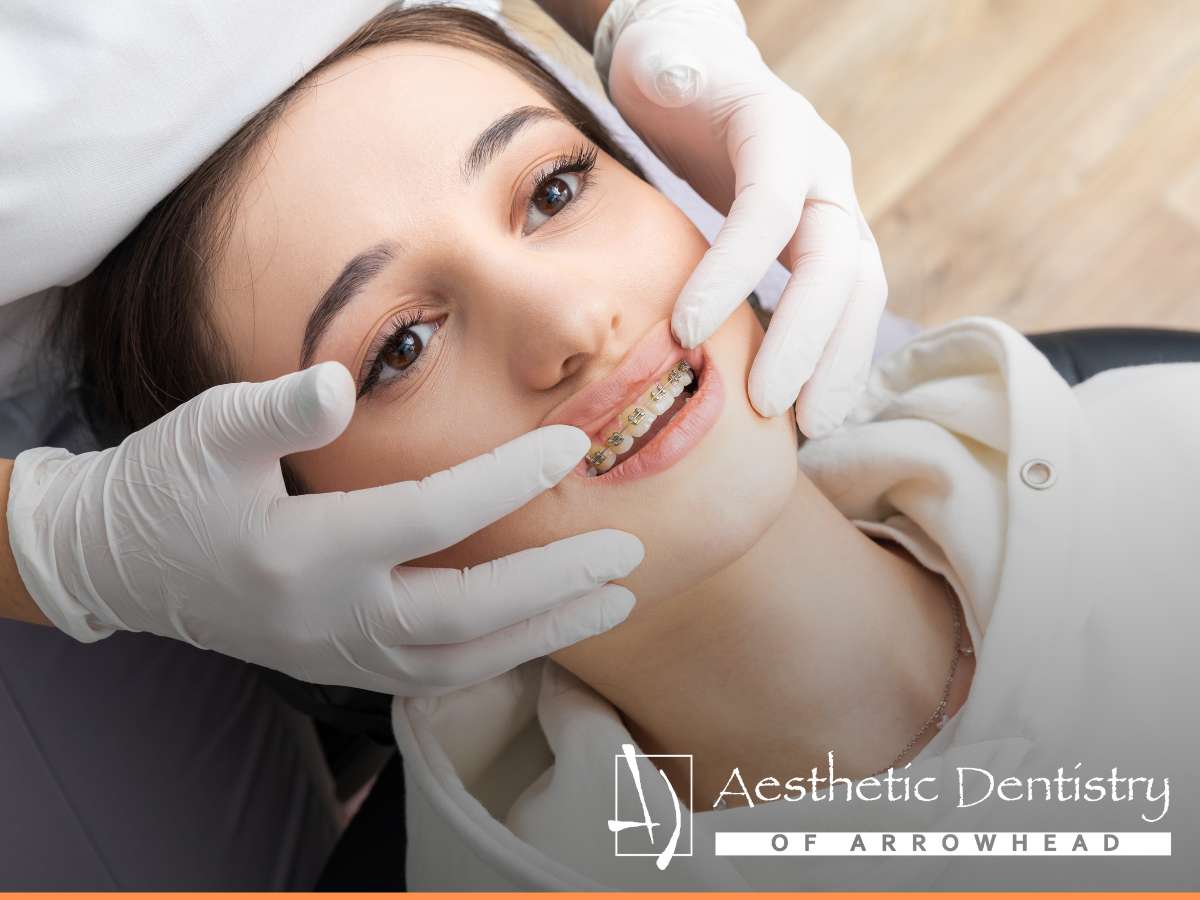What Are The Benefits Of Braces For Your Oral Health