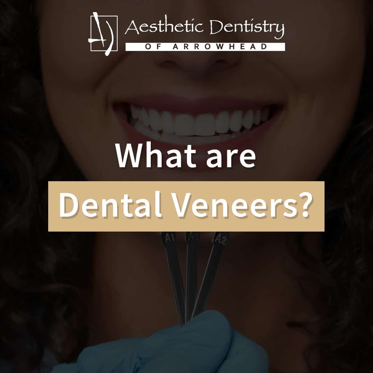 What are Dental Veneers?