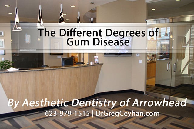 The Different Degrees of Gum Disease — Aesthetic Dentistry of Arrowhead