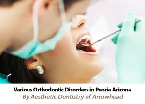 Various Orthodontic Disorders in Peoria, Arizona, by Aesthetic Dentistry of Arrowhead