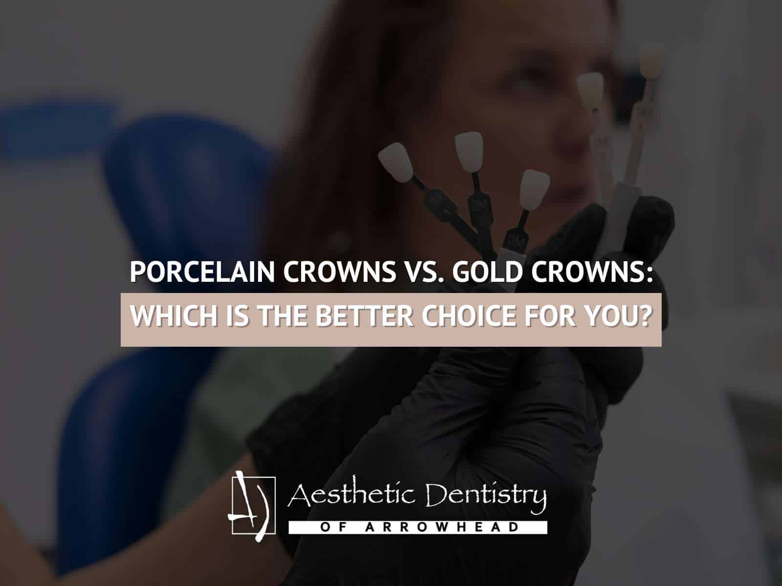 Porcelain Crowns vs. Gold Crowns: Which Is The Better Choice For You?