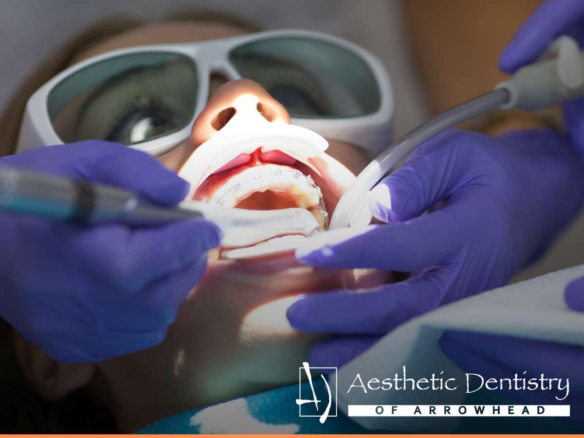 Dental patient with braces during treatment at Aesthetic Dentistry of Arrowhead