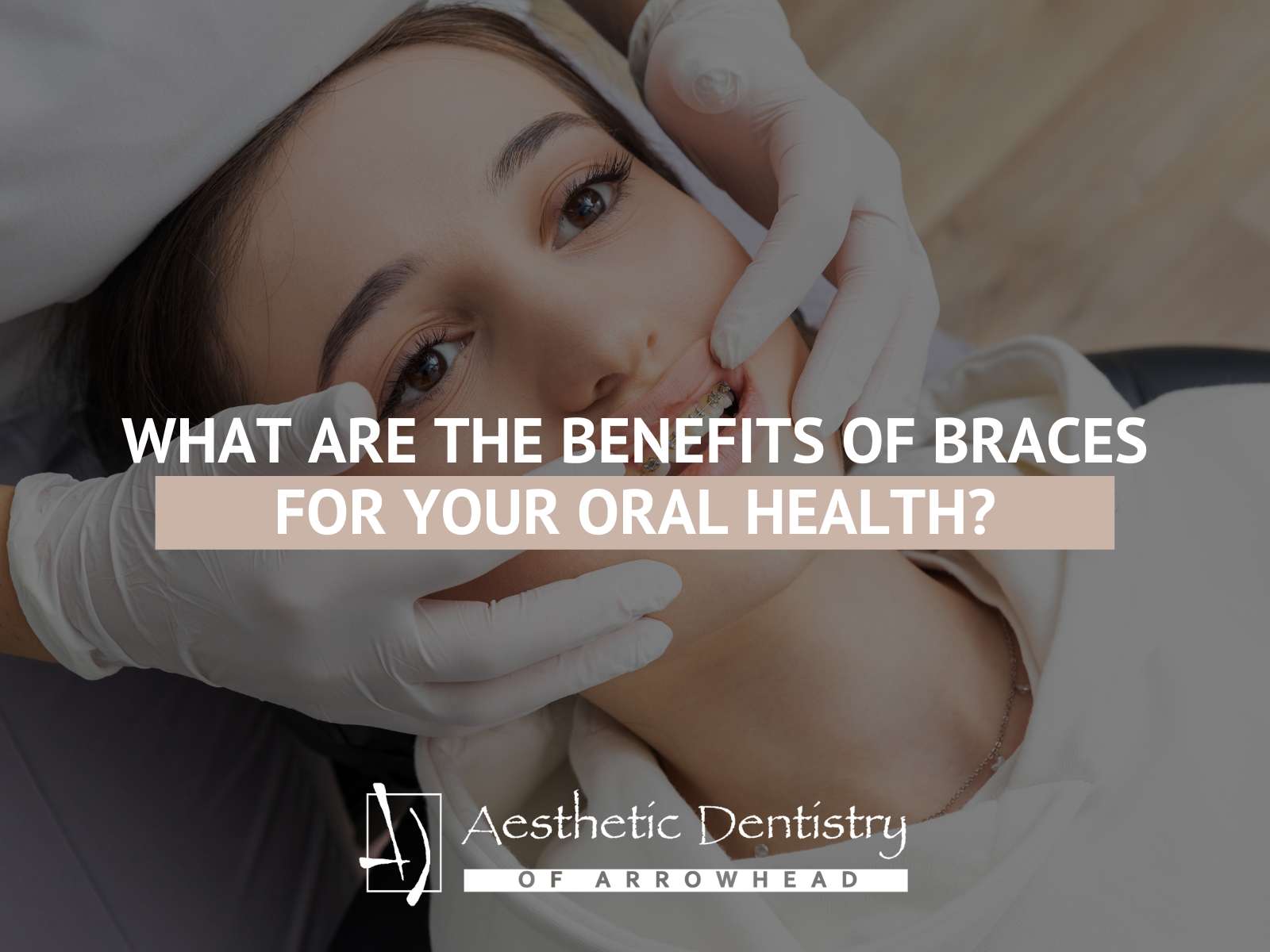 What Are The Benefits Of Braces For Your Oral Health