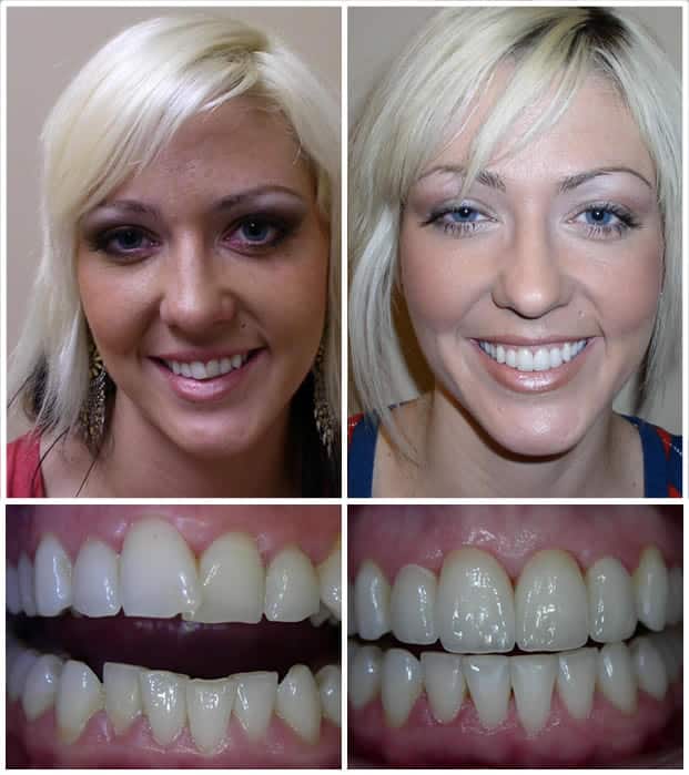 Smile Gallery Full Face